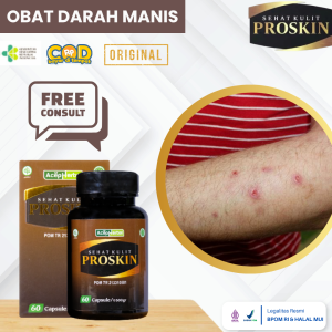 Obat Darah Manis Obat Penyakit Prurigo Obat Penghilang Darah Manis Obat Gatal Prurigo Penghilang Bekas Luka Menghitam Alergi Gigitan Nyamuk Luka Bernanah Obat Gatal Darah Manis Anak Dan Dewasa Dengan PROSKIN