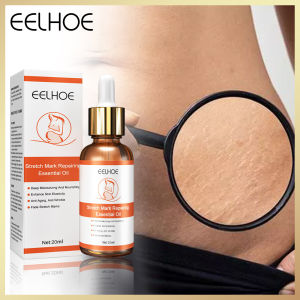 Eelshu ชุดซ่อมรอยถลอกน้ำมันหอมระเหยขจัดการตั้งครรภ์กระชับ F2r0ป้องกันริ้วรอยของผิวรอยแผลเป็นดูแลฟื้นฟูการตั้งครรภ์ (20มล.)