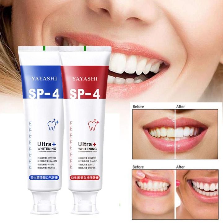 Strengthen Teeth Yellowing Repair Repair Teeth Tooth Whitening