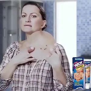 Ubat Kutil & Skin Tags Remover Warts removal cream Ubat kutil tahi lalat ketuat dan biji kolesterol mole remover Skin Tags Remover kutil removal