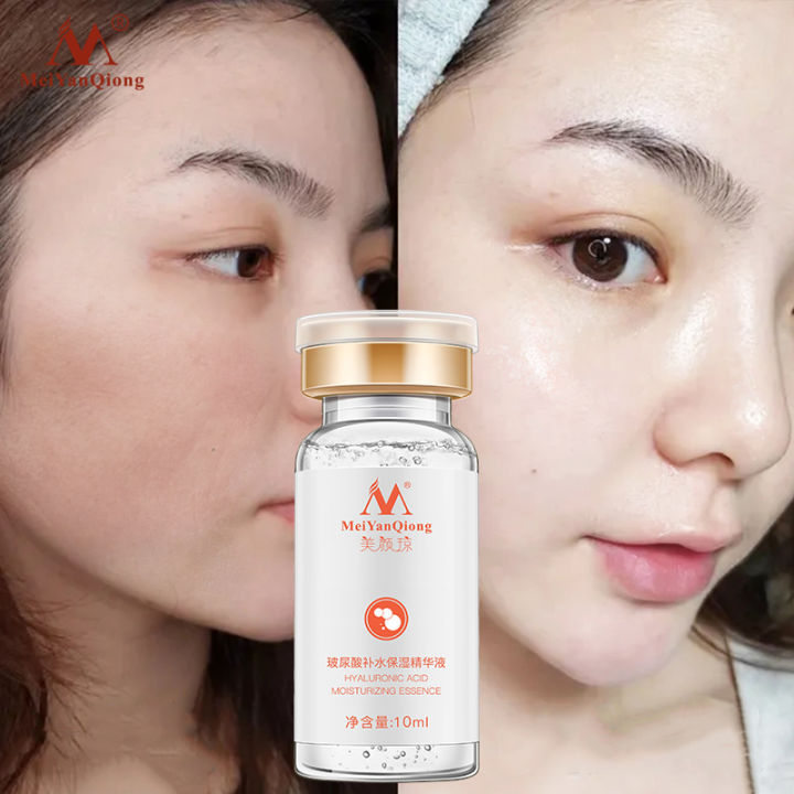 MeiYanQiong Hyaluronic Acid Anti Winkles Anti Aging Serum Face Care ...