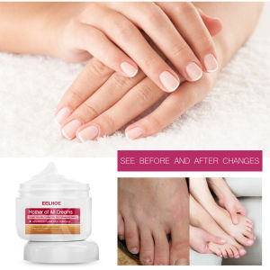 EELHOE Hand and Foot Moisturizer 30g - Itch Relief Moisturizing Cream Skin Care Soothing Cream for Cracked Skin