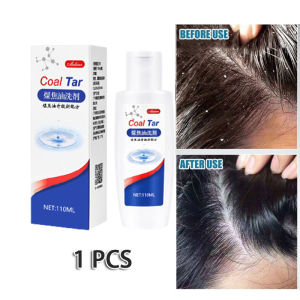 100ML Anti Dandruff Shampoo Coal Tar Hair Loss Shampoo Oil Control Hair Care 煤焦油洗剂