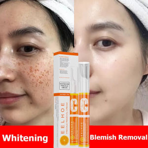 Kem diệt tàn nhang (Loại bỏ tàn nhang nhanh chóng) kem làm trắng da hiệu quả kem ngừa nám Chuyên sâu Loại bỏ các đốm đen Sắc tố làm sáng da Chăm sóc da chống nắng Loại bỏ tàn nhang Loại bỏ Melanin Chăm sóc Da trắng sáng Tự nhiên