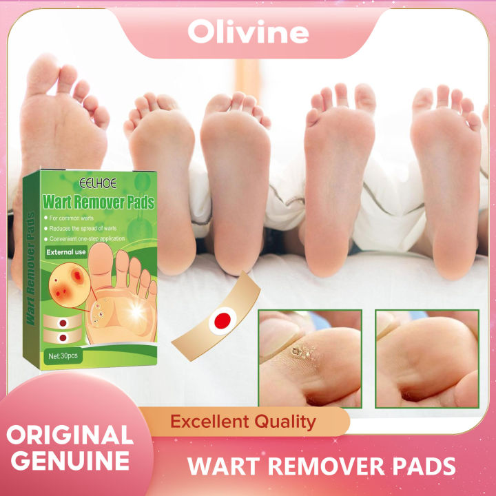 EELHOE Foot Corn Plaster Calluses Warts Removal Plantar Thorn Pain
