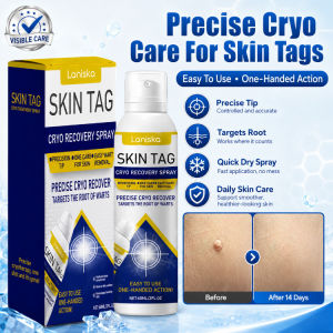 Wart Care Spray Natural Formula Wart Removal Solution Painless Skin Wart Treatment Spray Effective Wart Care For All Skin Types