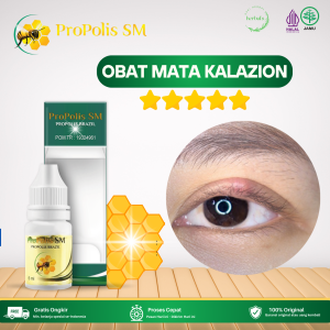 Obat Mata Kalazion Obat Mata Bintitan Obat Bintitan Di Bawah Mata Obat Bisul Kecil Di Kelopak Mata Obat Kelopak Mata Bengkak Dan Nyeri Obat Sakit Mata Obat Penghilang Benjolan Di Kelopak Mata Dengan Propolis SM