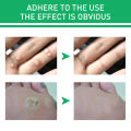 Jaysuing Warts Remove Liquid Smooth Skin Gentle Foot Care Ready Stock Wholesale. 