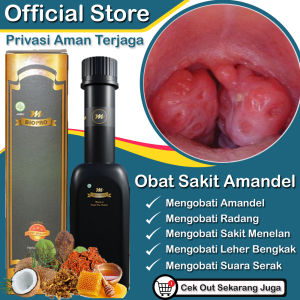 Obat Amandel Anak Paling Ampuh - Amandel Dewasa - Radang Tenggorokan - Amandel Tanpa Operasi -Amandel Anak 7 Tahun - Sakit Menelan - Amandel Kronis - Amandel Akut - Dengan Mbiopro Herbal Alami
