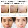 Chalonese Cream Mencerahkan Flek Hitam Menyamarkan Melasma Noda Hitam Di Wajah 20g. 