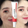 Original Whitening Freckle Cream Pekas Remover FOR ALL SKIN TYPES Melasma Remover Oitment Melasma Cream Pantanggal ng Pekas Pantanggal ng Melasma. 
