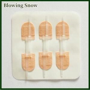 Blowing Zipper Tie Wound Closure Patch Hemostatic PatchWound Fast Suture Zipper Band-Aid