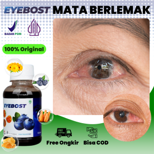Obat Penghilang Lemak Mata Herbal Mata Berlemak Berselaput Berlamad Pterigium Pterygium - Eyebost Original