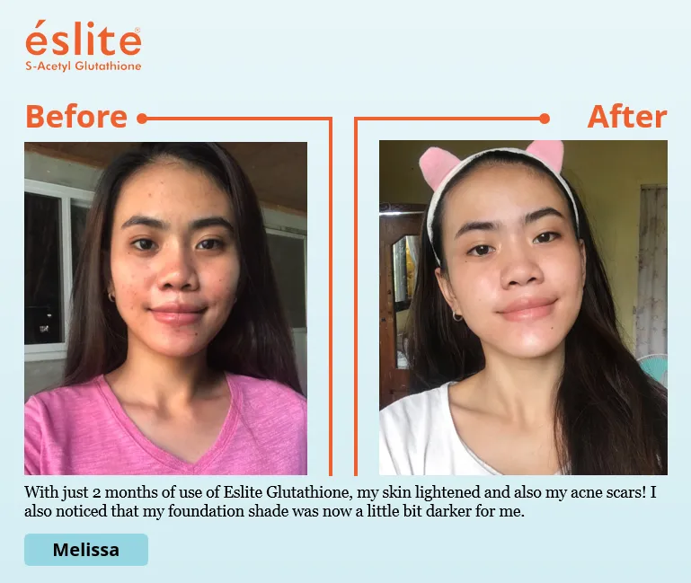 eslite glutathione review What To Avoid While Taking Glutathione
