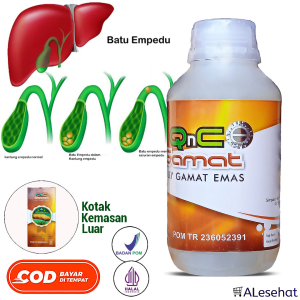 Obat Penghancur Batu Empedu Herbal Qnc Jelly Gamat Asli