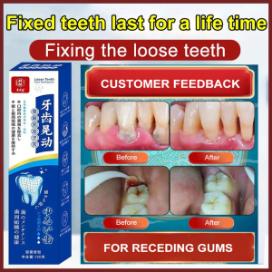 【牙齿松动101%冶好】日式进口牙齿松动牙膏 Japanese Imported Toothpaste for Loose Teeth 100% Natural Formula Strengthens Gums Reduces Tooth Mobility Gum Care Natural Gum Strengthener Enamel Safe Dental Care Herbal Formula Anti Bleeding