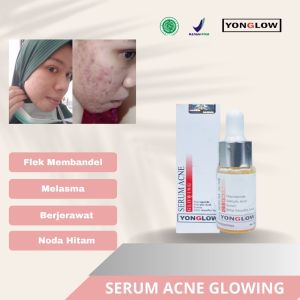 Yonglow Skincare Serum Acne Glowing Kulit Wajah Kusam Jerawat Beruntusan Komedo Pori pori