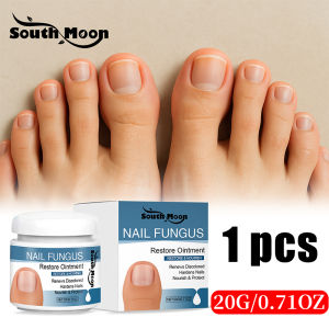 Fungal Nail Solution👌SOUTH MOON Nail repair cream nail treatment fungal ointment 20g for repair damaged nails， Effective Fungus Removal and Onychomycosis Nail care essence anti Fungal nail cream Nail repair serum gamot sa nasisirang kuko