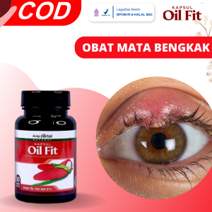 Obat Mata Bengkak Obat Mata Bintittan Obat Radang Kelopak Mata Penghilang Benjolan Di Kelopak Mata Obat Kelopak Mata Bengkak Pengempes Kalazion Obat Mata Ada Penumpukan Cairan Obat Mata Bengkak Penyebab Alergi Dengan Oil Fit