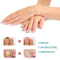 【100% Effective】Jaysuing Fungal Nail Treatment Patch Anti Infection Paronychia Thickening Soft Waterproof 32pcs. 