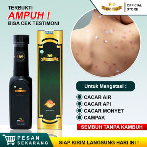 Obat Cacar Air Cacar Api Cacar Monyet Campak Penghilang Bekas Cacar Paling Ampuh Untuk Anak Dan Dewasa - Mbiopro Asli Original