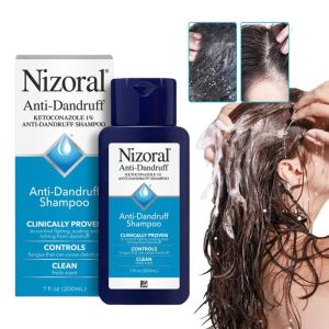 Nizoral 200ml Anti-Dandruff Shampoo Hair Care For Women And Men Itching Scalp