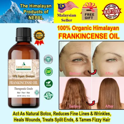 100% Organic Frankincense Oil - THERAPEUTIC GRADE (50ml)