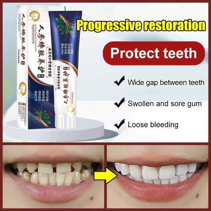 Loose Teeth Care Toothpaste Quick Repair Of Cavities Teeth Whitening ...