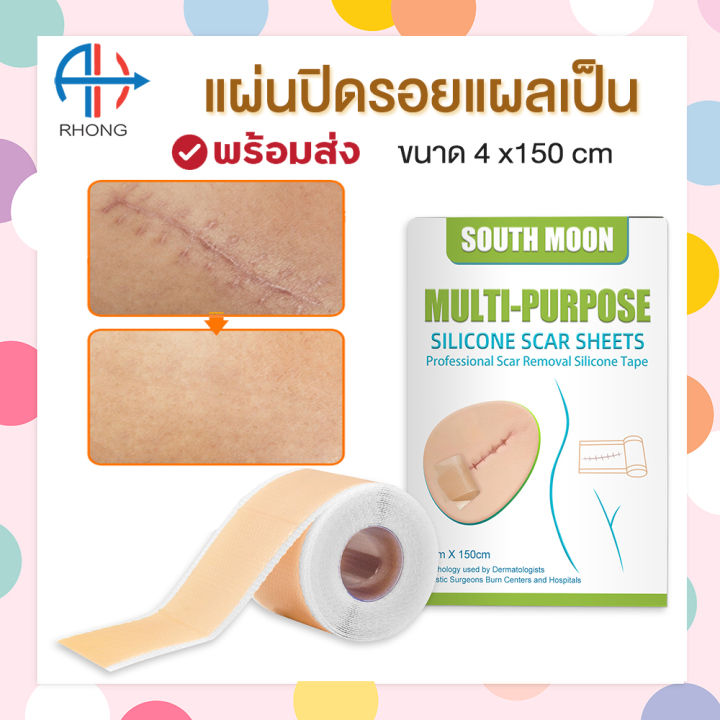 South Moon แผ่นปิดแผลซิลิโคน แผ่นแปะรอยแผลเป็น ซิลิโคนปิดแผล ขนาด 4cmx150cm Th