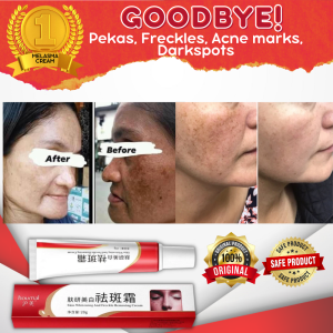 Pekas Remover Melasma Acne Dark Spot Melanin Pigmentation Moisturizing Skin Care