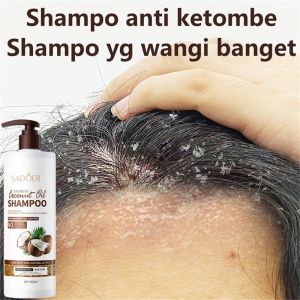 Shampo anti ketombe Coconut shampo Sampo anti gatal dan antiketombe Sampo ketombe