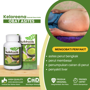 Obat Asites Perut Bengkak Obat Perut Membesar Obat Penumpukan Cairan Di Perut Obat Busung Air Obat Perut Kembung Obat Penyakit Liver Obat Hepatitis Obat Sirosis Hati Edema Perifer Obat Perut Kembung Dengan Keloreena