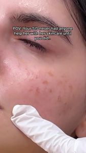 offical promotion [CHARDE] Mela Peel Cream Mask 50ml ｜ Dark Spot & Pigmentation Care Brightening Glowing Skin Retinol Niacinamide Glutathione Face Mask