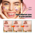 Eelhoe Colorful Acne Patch Star Pimple Patch Acne Coloful Invisible Acne Removal Stickers Originality Concealer Face Spot Beauty Makeup Tool L Invisible Acne Removal Pimple Patch Beauty Acne Tools Pimple Acne Concealer Face Spot Scar Care Stick(122pcs). 