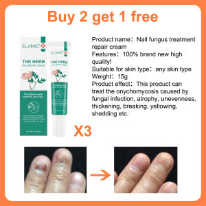 Nail repair Cream 15g Nail fungus treatment nail care cream anti-cracking fungal infection Quickly repair damaged nails Safe Chinese Herbal Medicine