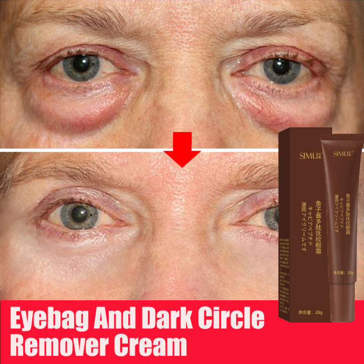 Caviar Eye Cream Wrinkle Eye Cream Eye Bag Remover Cream Original