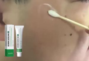 EELHOE Skin Neck Cream Improves dull skin moisturizes and brightens skin and treats acne