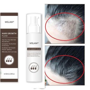 Tinh Chất Giúp Mọc Tóc Và Phục Hồi Tóc Hiệu Quả MSLAM Hair Growth Fluid Giải Pháp An Toàn Cho Người Bị Rụng Tóc