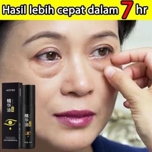 Serum Mata Cream 20ml Eye Cream Menghilangkan Kantung Mata Dengan Cepat Krim Mata Anti Kerut