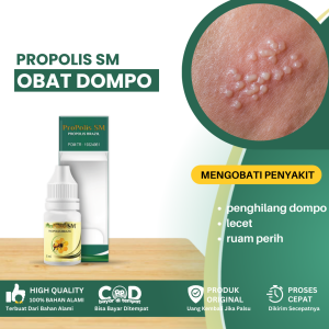 Obat Penyakit Dompo Obat Penghilang Dompo Obat Sakit Dompo Obat Dompo Di Wajah/ Di Bibir / Di Muka Obat Dompo Kering Obat Dompo Biar Cepet Kering Herves Oral Herpes Lbialis - Propolis SM