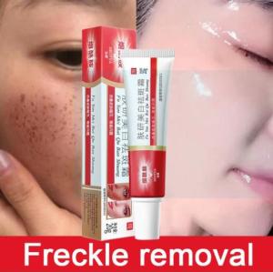 🔥 Whitening Freckle Cream 20g Salep Krim Penghilang Flek Hitam di Wajah Penghilangkan Bintik Gelap Anti Bintik Niacinamide Memudar Pigmentasi Melasma Dan Mencerahkan Krim