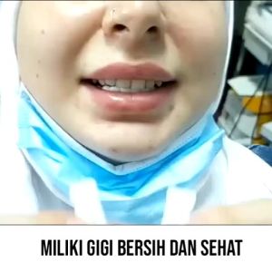 Snap on Smile 100% Authentic Gigi Palsu 1 SET ATAS BAWAH VENEER GIGI PALSU BEST SELLER SNAP ON SMILE