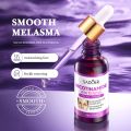 SAODER Whitening Essence Serum Remove Whiten Facial Moisturize Serum Remove Freckle Fade Dark Spot Anti-aging Whiten Facial Moisturize Serum Wajah Glowing Whitening Essence Niacinamide Skin Serum pencuci flek Removing Dark spot. 