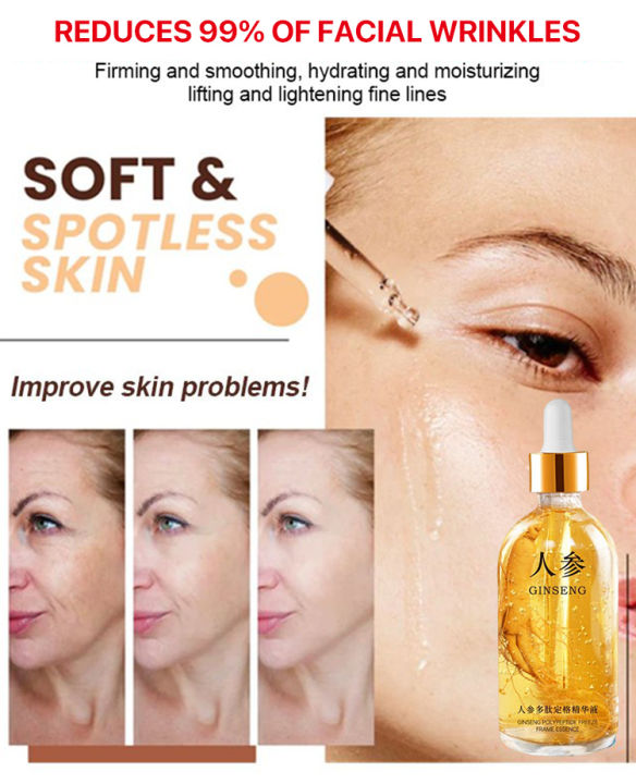 Ginseng Polypeptide Anti-ageing Essence Lightens Eye Skin Nasolabial ...