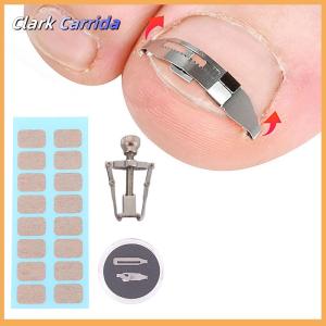 [Clark Carrida] Ingrown Toenail Tools Pedicure Recover Embed Toe Nail Treatment Professional Foot Care Correction Tool Care Foot