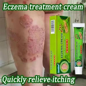 Original Psoriasis Cream Skin Care Cream Psoriasis Skin Cream Dermatitis Eczematoid Eczema Ointment Treatment 20g Psoriasis Eczema Itchiness Organic Skin Ointment Natural Herbal Multi Plant Extract Anti Bacterial Anti Fungal 👍
