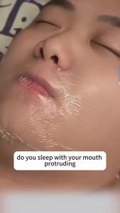 KOEC Sleep breathing patch relieves breathing prevents snoring and stops snoring by closing the mouth and nose and is applied to the lips