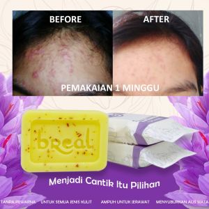 Sabun Jerawat Dan Bekas Jerawat | Sabun Saffron Breal | Perawatan Wajah Jerawat | Saffron Soap Breal Sabun Jerawat Soap Saffron BREAL Sabun Safron 20
