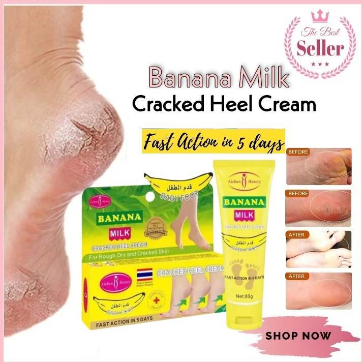 100% EFFECTIVE Banana Milk Cracked Heel Cream Baby Foot Anti Chapped  Ointment Repair Moisturizing Power Crack Heel Cream Foot Peeling Cracked  Hands