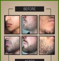 Original Pampatubo ng Balbas at bigote  Beauty Beard Growth oil  hair growth essential oil natural Pampatubo ng 30ml. 
